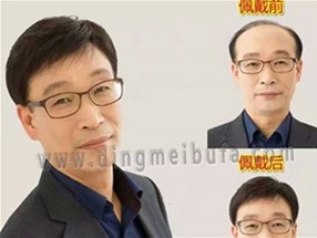 為什么有的男士發型很酷炫，那是做了補發哦