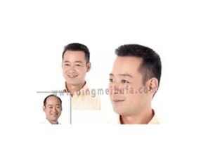脫發人的中年危機只是偽命題 教你如何一招解決形象尷尬！